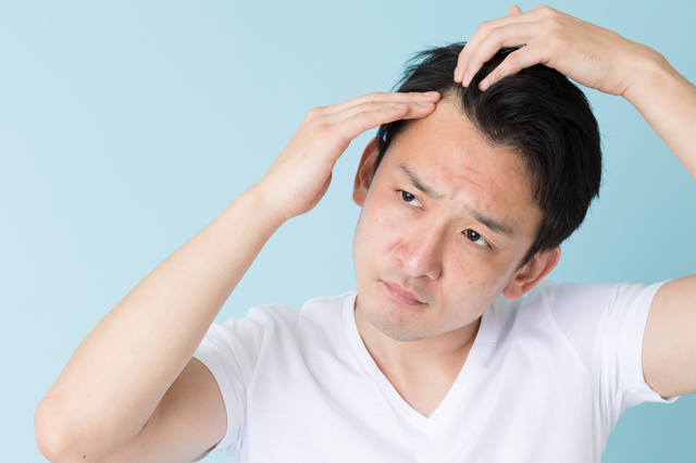 男性の薄毛の原因