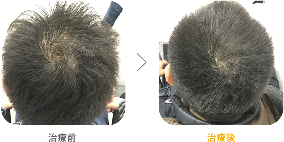 男性 症例1
